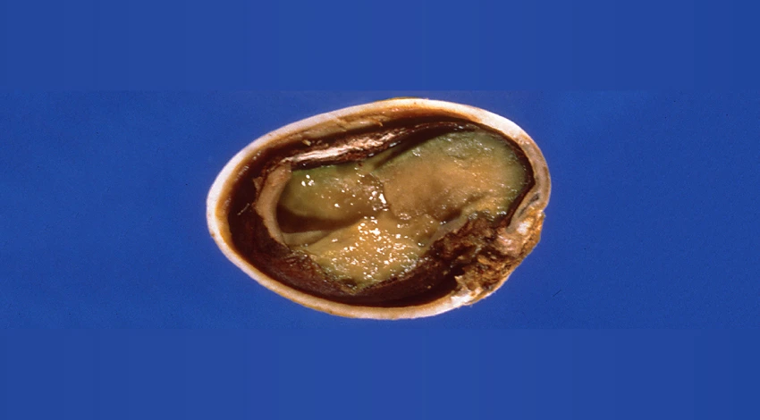 بیماری ماسوی پسته
https://ipm.ucanr.edu/agriculture/pistachio/stigmatomycosis/